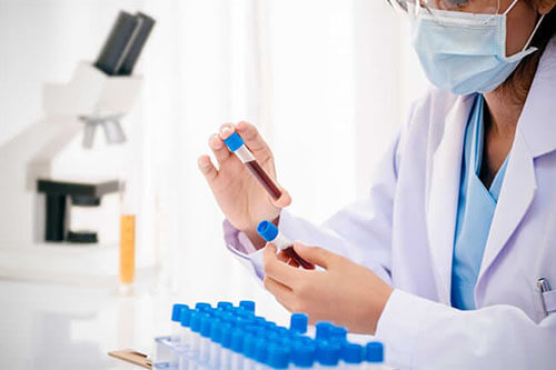Ngành xét nghiệm hiện đang cần có nhiều nhu cầu về nhân lực Ngành xét nghiệm hiện đang cần có nhiều nhu cầu về nhân lực
