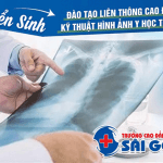 Tuyển sinh Liên thông Cao đẳng kỹ thuật hình ảnh Y học Sài Gòn