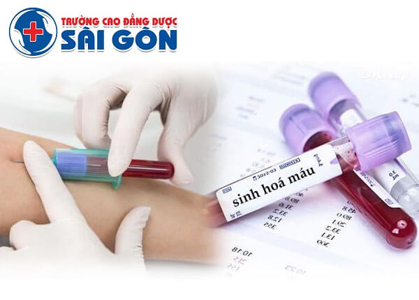 Tuyển sinh Cao đẳng xét nghiệm sài gòn chính quy