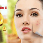 Dược Sài Gòn tư vấn cách sử dụng vitamin E giúp làm đẹp da