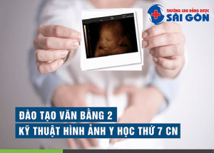 Tuyển sinh Văn bằng 2 Kỹ thuật Hình ảnh Sài Gòn năm 2019