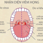 YHCT Sài Gòn bật mí bài thuốc dân gian xóa tan nỗi lo viêm họng