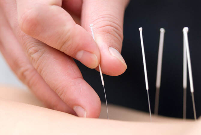 Bác sĩ y học cổ truyền bật mí lợi ích của việc châm cứu bấm huyệt trị bệnh