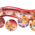 Kiểm soát rối loạn Lipid huyết cùng chuyên gia Điều dưỡng Sài Gòn