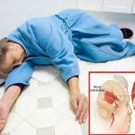 Tìm hiểu biện pháp phòng ngừa đột quỵ cùng Điều dưỡng Sài Gòn