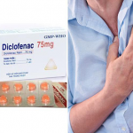 Tìm hiểu nguy cơ tim mạch khi sử dụng Diclofenac từ Dược Sài Gòn