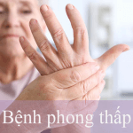Y sĩ Y học cổ truyền Sài Gòn nói gì về bệnh phong thấp