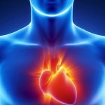 Y sĩ YHCT Sài Gòn hướng dẫn phòng ngừa bệnh xơ vữa động mạch
