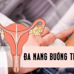 Phụ nữ bị đa nang buồng trứng có khả năng mang thai không?