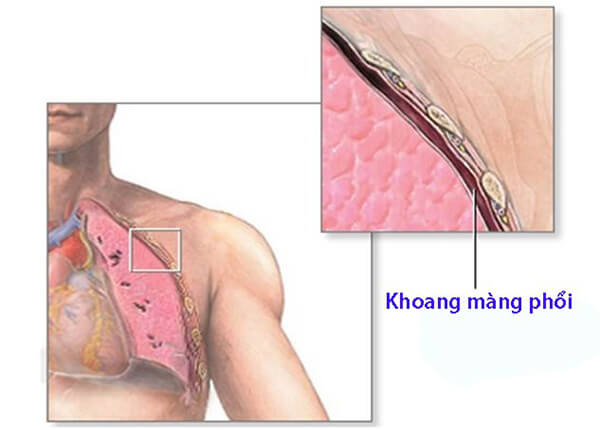 Vị trí màng phổi Vị trí màng phổi