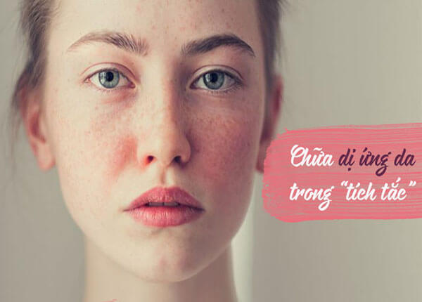 Da mặt bị dị ứng và những cách xử lý đơn giản tại nhà Da mặt bị dị ứng và những cách xử lý đơn giản tại nhà