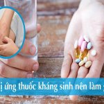 Dược sĩ Trường Dược Sài Gòn chia sẻ về tình trạng dị ứng thuốc kháng sinh