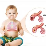 Nguyên nhân và triệu chứng thường gặp ở trẻ em mắc bệnh viêm phế quản