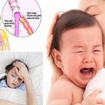 B.s Trường Dược Sài Gòn tư vấn cách chăm sóc trẻ bị viêm phế quản