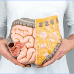 Những lưu ý về hội chứng Zollinger-Ellison từ B.s Trường Dược Sài Gòn