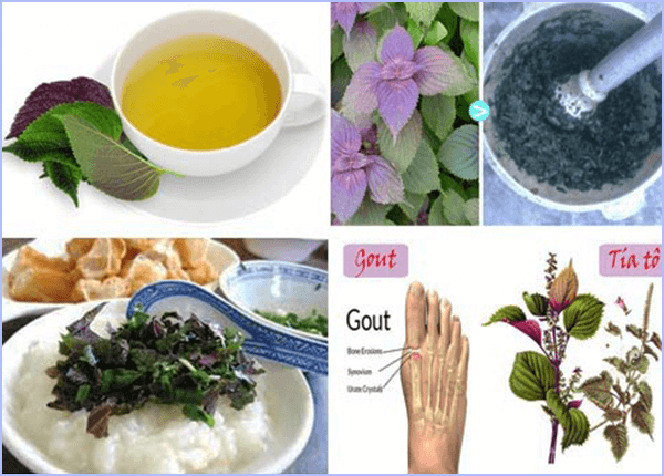 Trị bệnh gút từ lá tía tô Trị bệnh gút từ lá tía tô