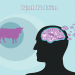Tìm hiểu nguyên nhân và triệu chứng phổ biến của bệnh bò điên