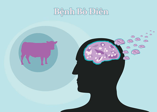 Bệnh bò điên Bệnh bò điên