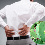 Y sĩ YHCT Sài Gòn chia sẻ bài thuốc chữa gai cột sống từ cây xương rồng