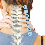 Cách điều trị bệnh gai cột sống cổ từ B.s Trường Dược Sài Gòn