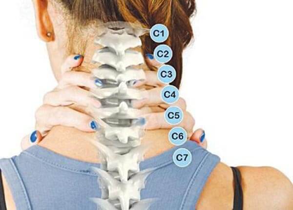 Bệnh gai cột sống cổ Bệnh gai cột sống cổ