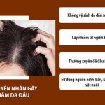 Tìm hiểu nguyễn nhân dẫn tới nấm da đầu từ B.s Trường Dược Sài Gòn
