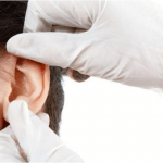 B.s Trường Dược Sài Gòn chia sẻ cách điều trị mụn nước ở vành tai