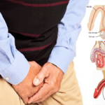 B.s Trường Dược Sài Gòn chia sẻ về bệnh ngứa đường tiết niệu