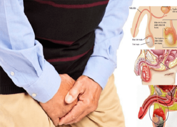 bệnh ngứa đường tiết niệu bệnh ngứa đường tiết niệu