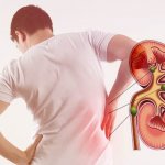 Tìm hiểu về các cấp độ suy thận từ B.s Trường Dược Sài Gòn