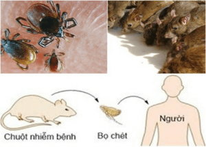 bệnh dịch hạch