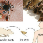 Bác sĩ Trường Dược Sài Gòn chia sẻ về bệnh dịch hạch