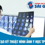 Cơ hội nghề nghiệp của Ngành Kỹ thuật hình ảnh Y học