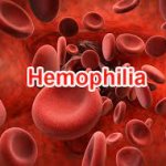 Bác sĩ Trường Cao đẳng Dược Sài Gòn nói gì về bệnh Hemophilia?