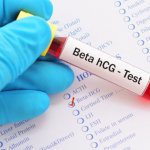 Xét nghiệm beta HCG có ý nghĩa gì trong chẩn đoán thai kỳ?