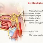 Nhận biết và điều trị đau dây thần kinh số 9