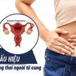 Cẩn trọng với tình trạng mang thai ngoài tử cung