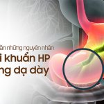 Nguyên nhân và cách phòng ngừa nhiễm vi khuẩn HP